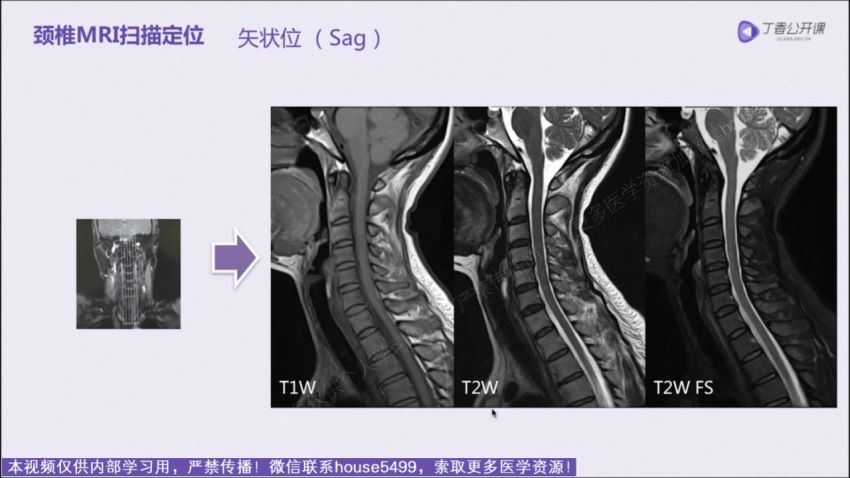 丁香园：脊柱MRI进阶指南【共11节】【全】【248元】 百度网盘分享(8.65G)